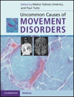 Uncommon Causes of Movement Disorders - ISBN 9780521111546