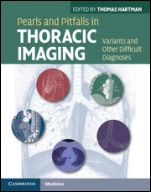Pearls and Pitfalls in Thoracic Imaging - ISBN 9780521119078