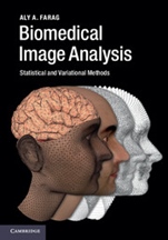 Biomedical Image Analysis - ISBN 9780521196796