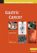 Gastric Cancer - ISBN 9780521513838