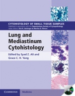 Lung and Mediastinum Cytohistology with CD-ROM - ISBN 9780521516587