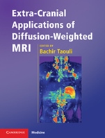 Extra-Cranial Applications of Diffusion-Weighted MRI - ISBN 9780521518697