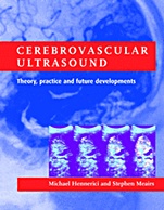 Cerebrovascular Ultrasound - ISBN 9780521632232