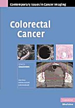Colorectal Cancer - ISBN 9780521692915