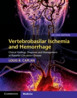 Vertebrobasilar Ischemia and Hemorrhage - ISBN 9780521763066