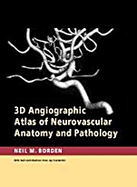 3D Angiographic Atlas of Neurovascular Anatomy and Pathology - ISBN 9780521856843