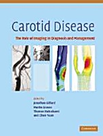 Carotid Disease - ISBN 9780521862264