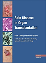 Skin Disease in Organ Transplantation - ISBN 9780521870672