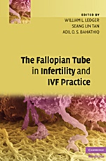 The Fallopian Tube in Infertility and IVF Practice - ISBN 9780521873789