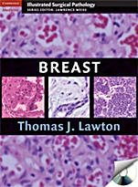 Breast - ISBN 9780521881593