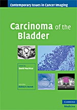 Carcinoma of the Bladder - ISBN 9780521884563