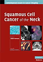 Squamous Cell Cancer of the Neck - ISBN 9780521886918