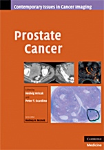 Prostate Cancer - ISBN 9780521887045