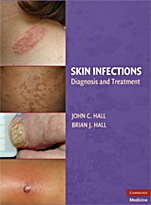 Skin Infections - ISBN 9780521897297