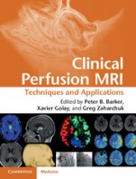 Clinical Perfusion MRI - ISBN 9781107013391