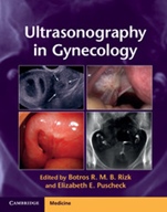 Ultrasonography in Gynecology - ISBN 9781107029743