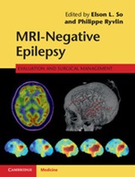 MRI-Negative Epilepsy - ISBN 9781107034235