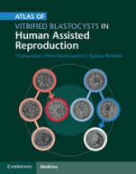 Atlas of Vitrified Blastocysts in Human Assisted Reproduction - ISBN 9781107074095
