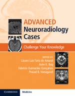 Advanced Neuroradiology Cases - ISBN 9781107088719