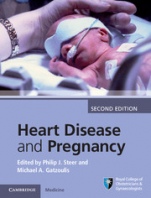 Heart Disease and Pregnancy - ISBN 9781107095946