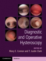 Diagnostic and Operative Hysteroscopy - ISBN 9781107111608