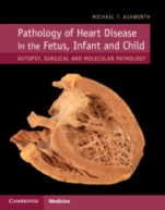 Pathology of Heart Disease in the Fetus, Infant and Child - ISBN 9781107116283