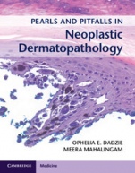 Pearls and Pitfalls in Neoplastic Dermatopathology with Online Access - ISBN 9781107584587