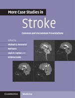 More Case Studies in Stroke - ISBN 9781107610033