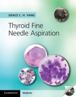 Thyroid Fine Needle Aspiration with CD Extra - ISBN 9781107618138