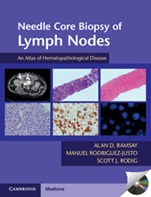 Needle Core Biopsy of Lymph Nodes with DVD-ROM - ISBN 9781107624542