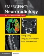 Emergency Neuroradiology - ISBN 9781107676138