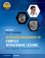 Integrated Management of Complex Intracranial Lesions Hardback Set and Static Online Product - ISBN 9781108782838