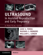 Ultrasound in Assisted Reproduction and Early Pregnancy - ISBN 9781108810210