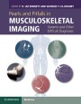 Pearls and Pitfalls in Musculoskeletal Imaging - ISBN 9780521196321