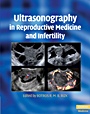 Ultrasonography in Reproductive Medicine and Infertility - ISBN 9780521509763