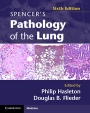 Spencers Pathology of the Lung 2 Part Set with DVDs - ISBN 9780521509954