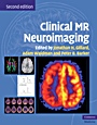 Clinical MR Neuroimaging - ISBN 9780521515634