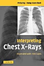 Interpreting Chest X-Rays - ISBN 9780521607322