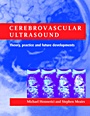 Cerebrovascular Ultrasound - ISBN 9780521632232
