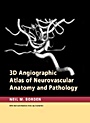 3D Angiographic Atlas of Neurovascular Anatomy and Pathology - ISBN 9780521856843