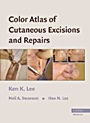 Color Atlas of Cutaneous Excisions and Repairs - ISBN 9780521860246