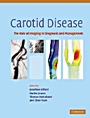 Carotid Disease - ISBN 9780521862264