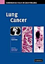Lung Cancer - ISBN 9780521872027