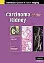 Carcinoma of the Kidney - ISBN 9780521878388