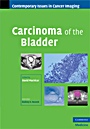 Carcinoma of the Bladder - ISBN 9780521884563