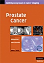 Prostate Cancer - ISBN 9780521887045