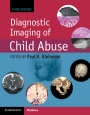 Diagnostic Imaging of Child Abuse - ISBN 9781107010536