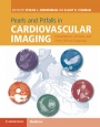 Pearls and Pitfalls in Cardiovascular Imaging - ISBN 9781107023727