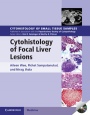 Cytohistology of Focal Liver Lesions - ISBN 9781107024175