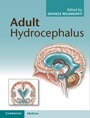 Adult Hydrocephalus - ISBN 9781107031777